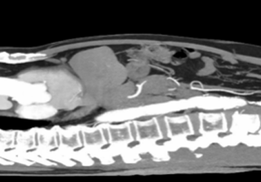 除外惡液質晚期 除外惡液質晚期